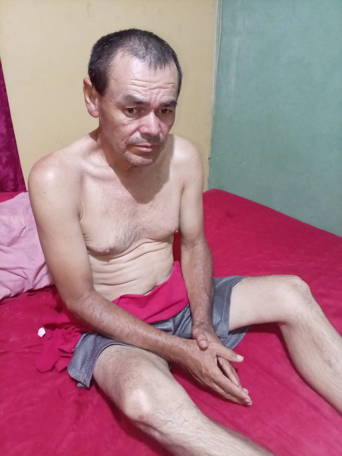 Lester Medrano antes de la cirugía