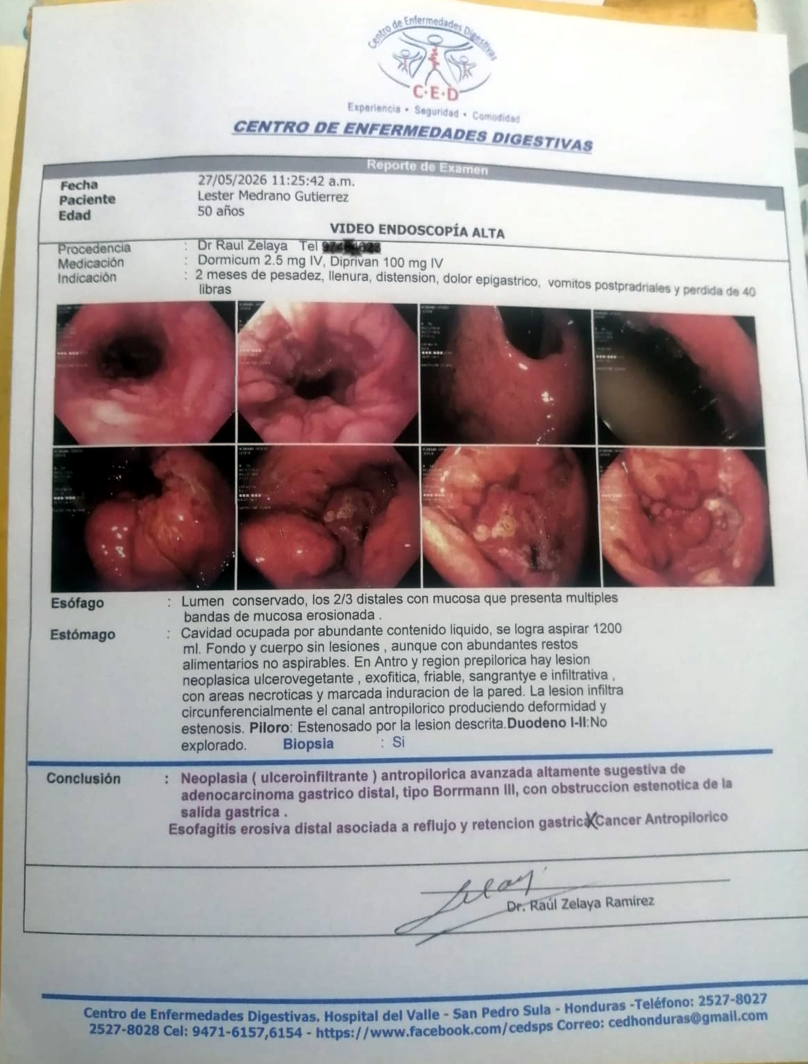 Reporte médico de Lester Medrano