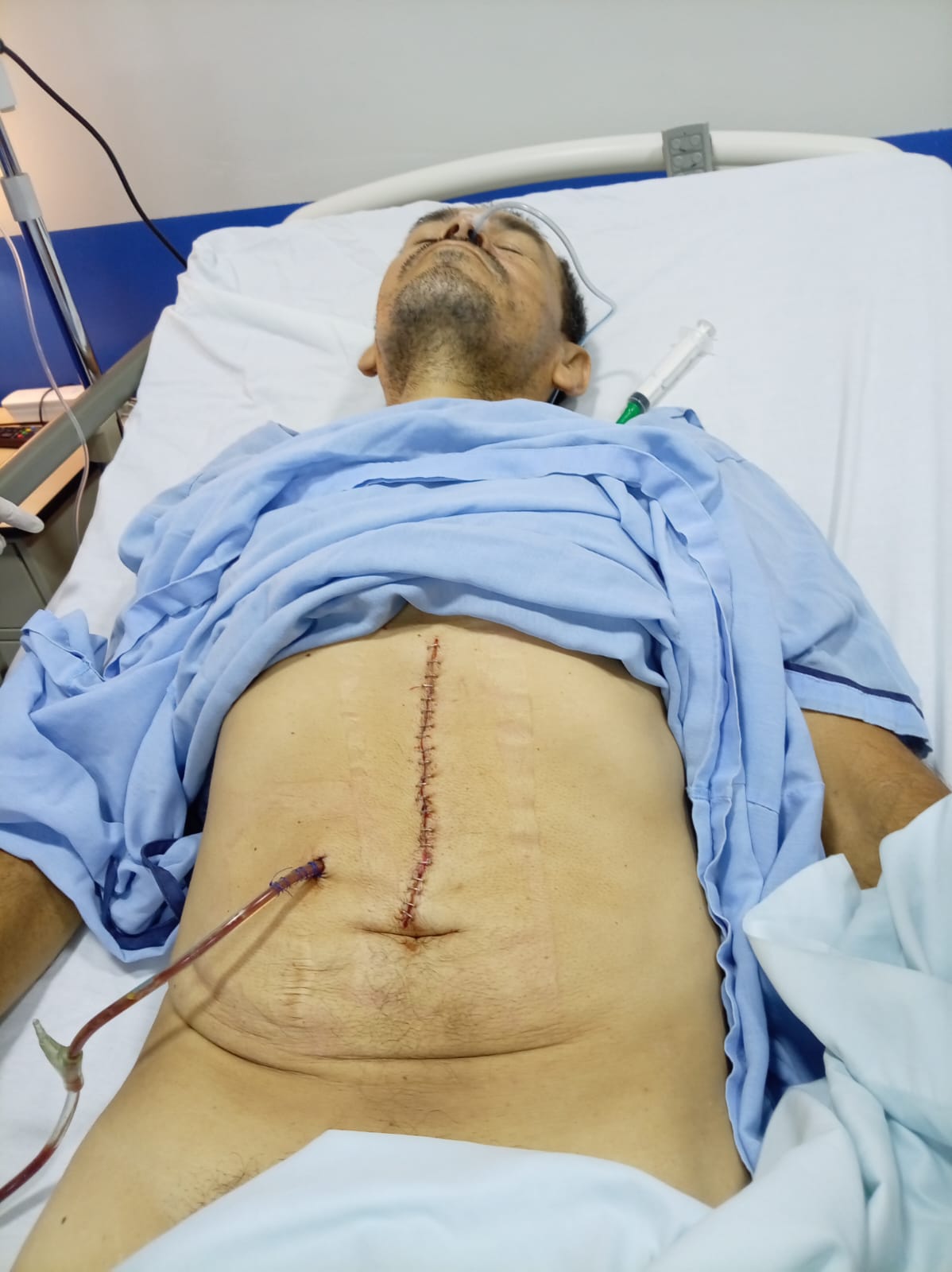 Lester Medrano después de la cirugía